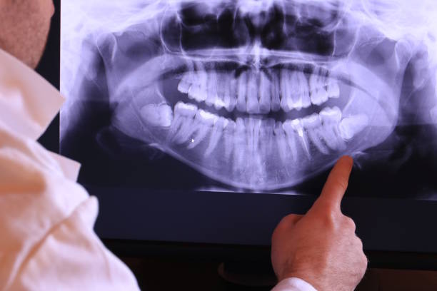 Best Emergency Root Canal Treatment in Geistown, PA
