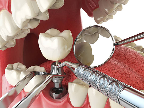 Best Emergency Dental Surgery in Geistown, PA
